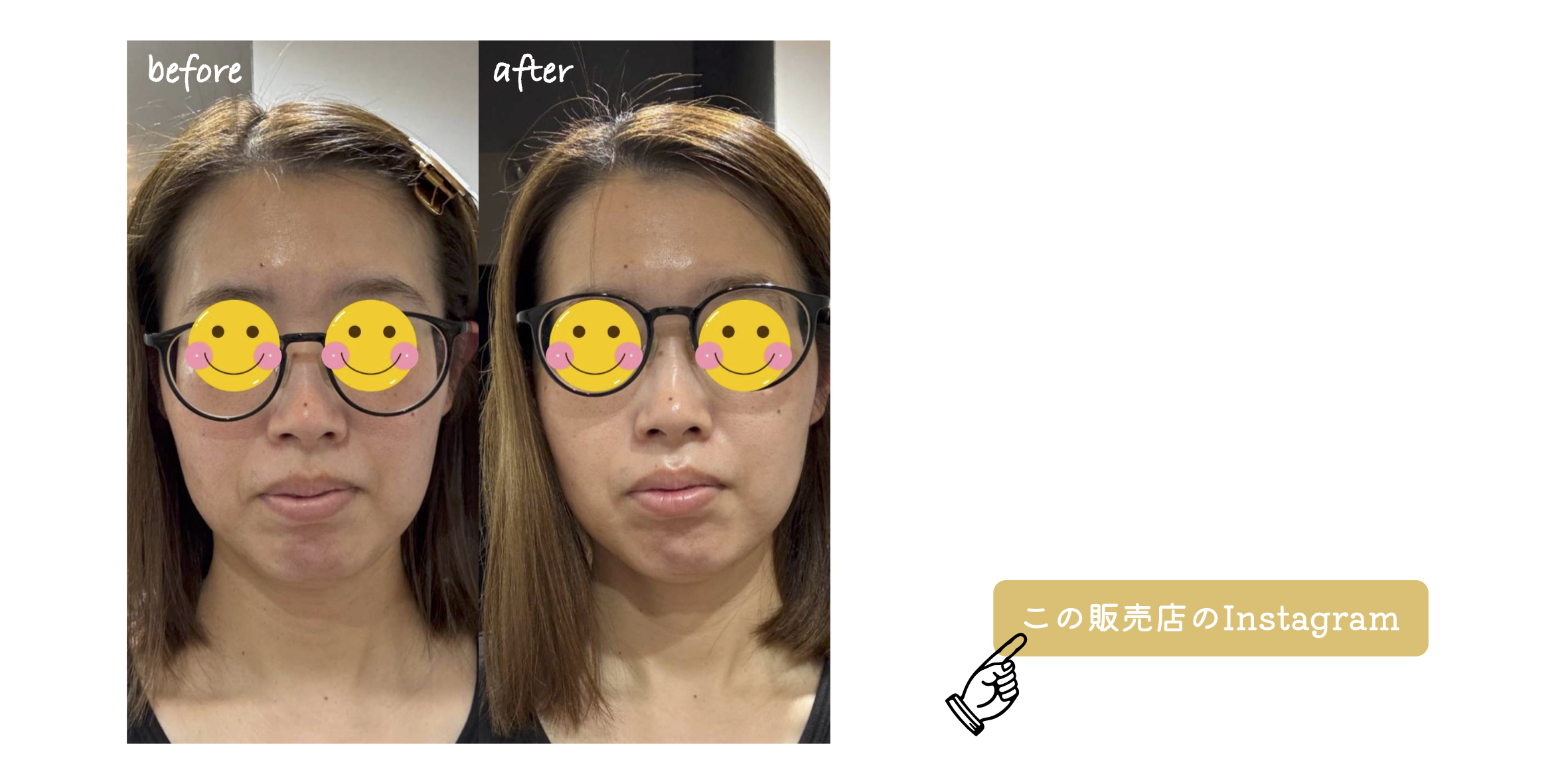 Before After 3