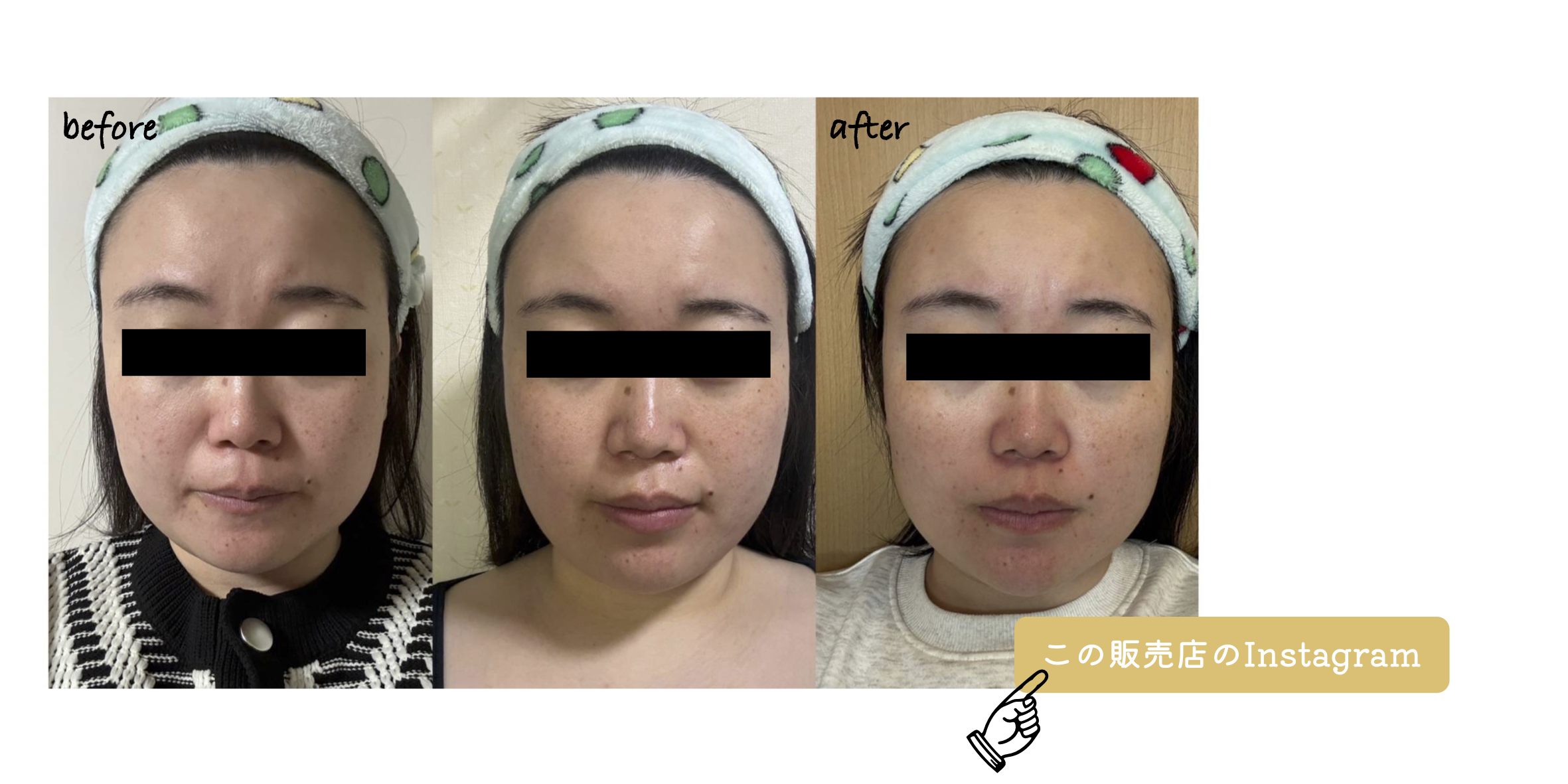 Before After 4